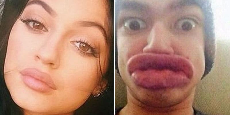 Kylie Jenner lip challenge funny