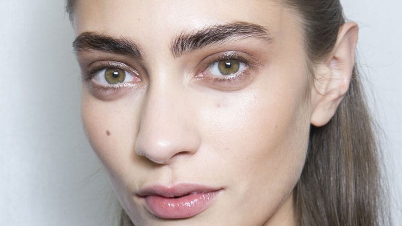 What Causes Under-Eye Bags