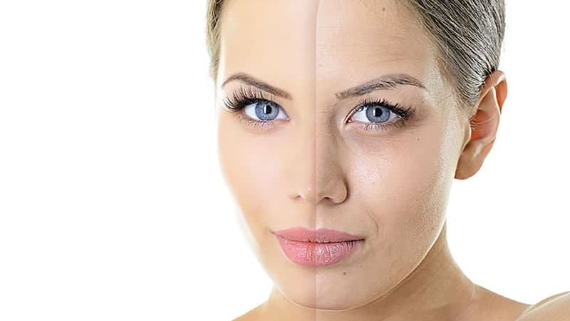 picosure-laser-treatment