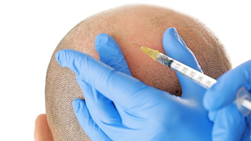 Man With Hair Loss Problem Receiving Injection On White Backgrou