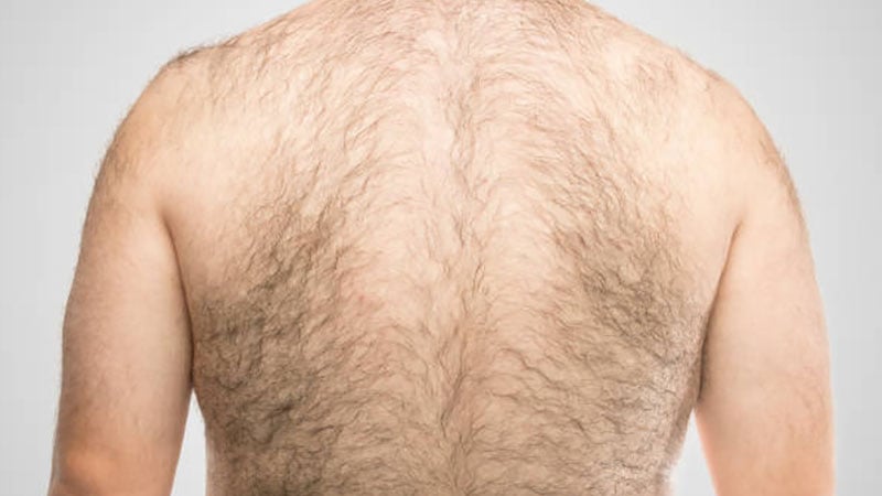Men why so hairy are 10 Celebrity