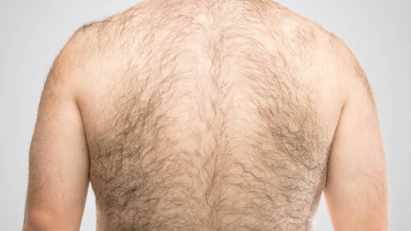 hairy back shaver