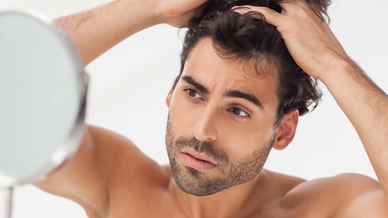 How To Get Rid Of Dandruff Naturally
