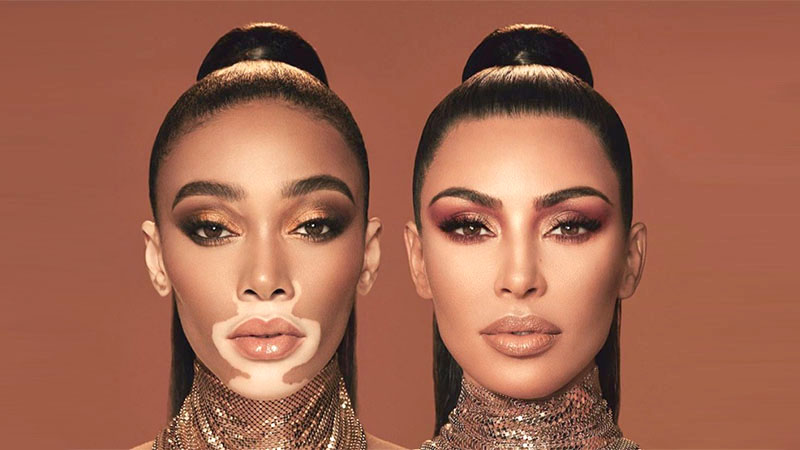 Kim Kardashian Is Collaborating With Winnie Harlow