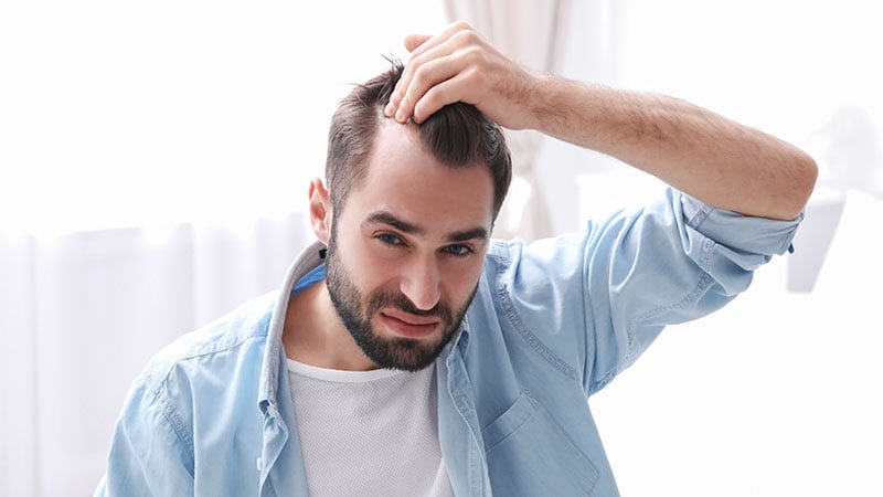 Young Man With Hair Loss Problem Indoors
