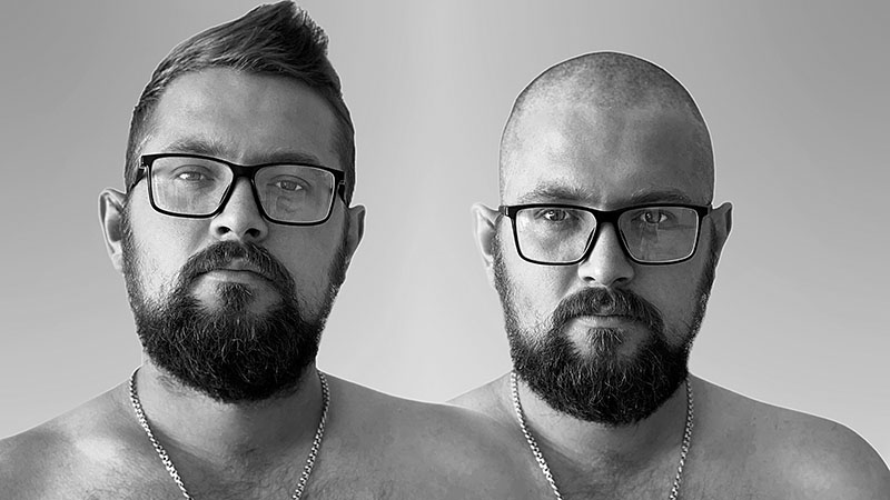 The Ultimate Hair Transplant Guide for Men in 2023 - The Trend Spotter The Ultimate Hair Transplant Guide for Men in 2023 - The Trend Spotter