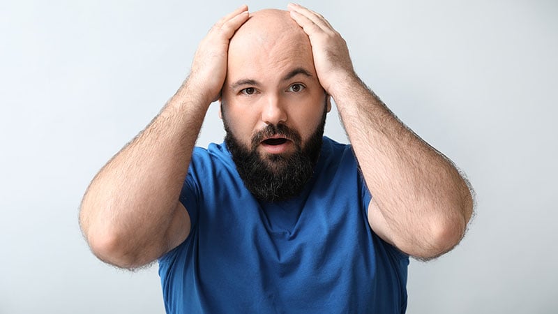 Man With Hair Loss Problem On Light Background