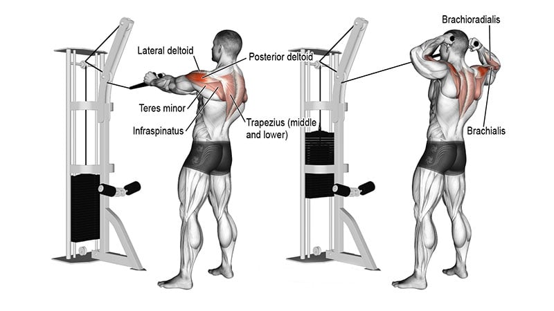 Face Pulls