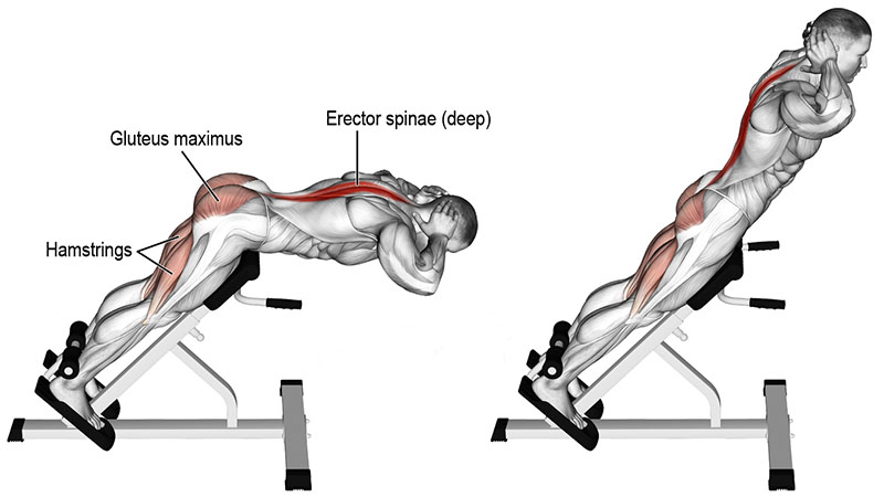 Hyperextension