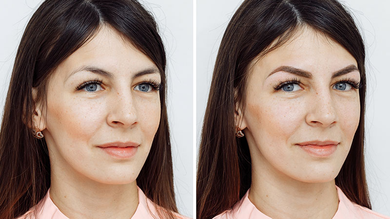 Before And After Eyebrow Microblading