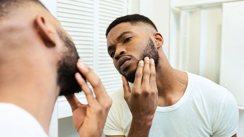How To Apply Minoxidil To A Beard