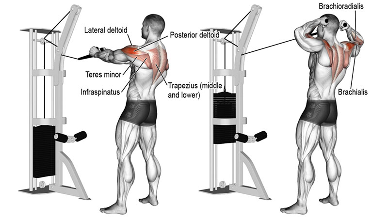 Face Pulls