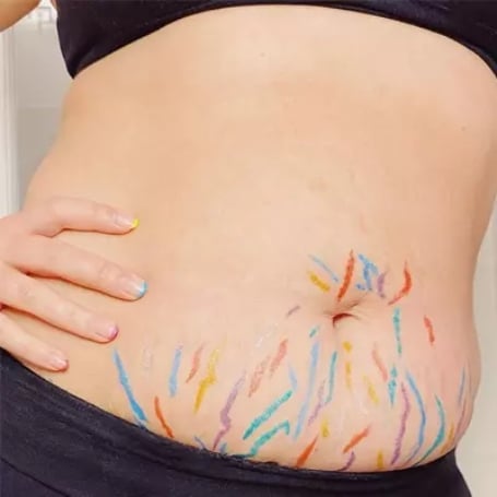 Stomach Stretch Mark Cover Up Tattoo